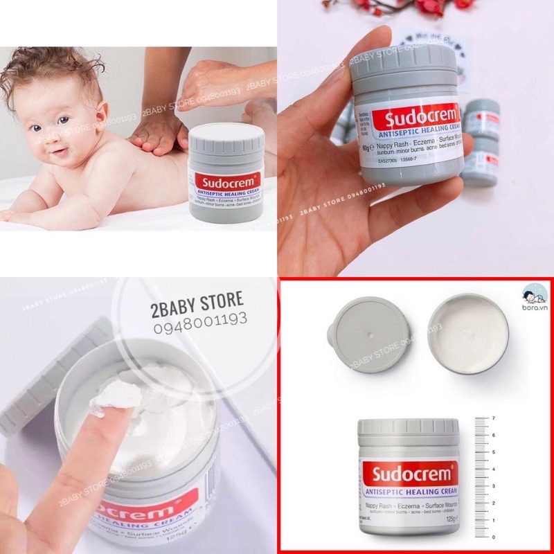 Kem chống hăm cho bé sudocrem hộp 60g