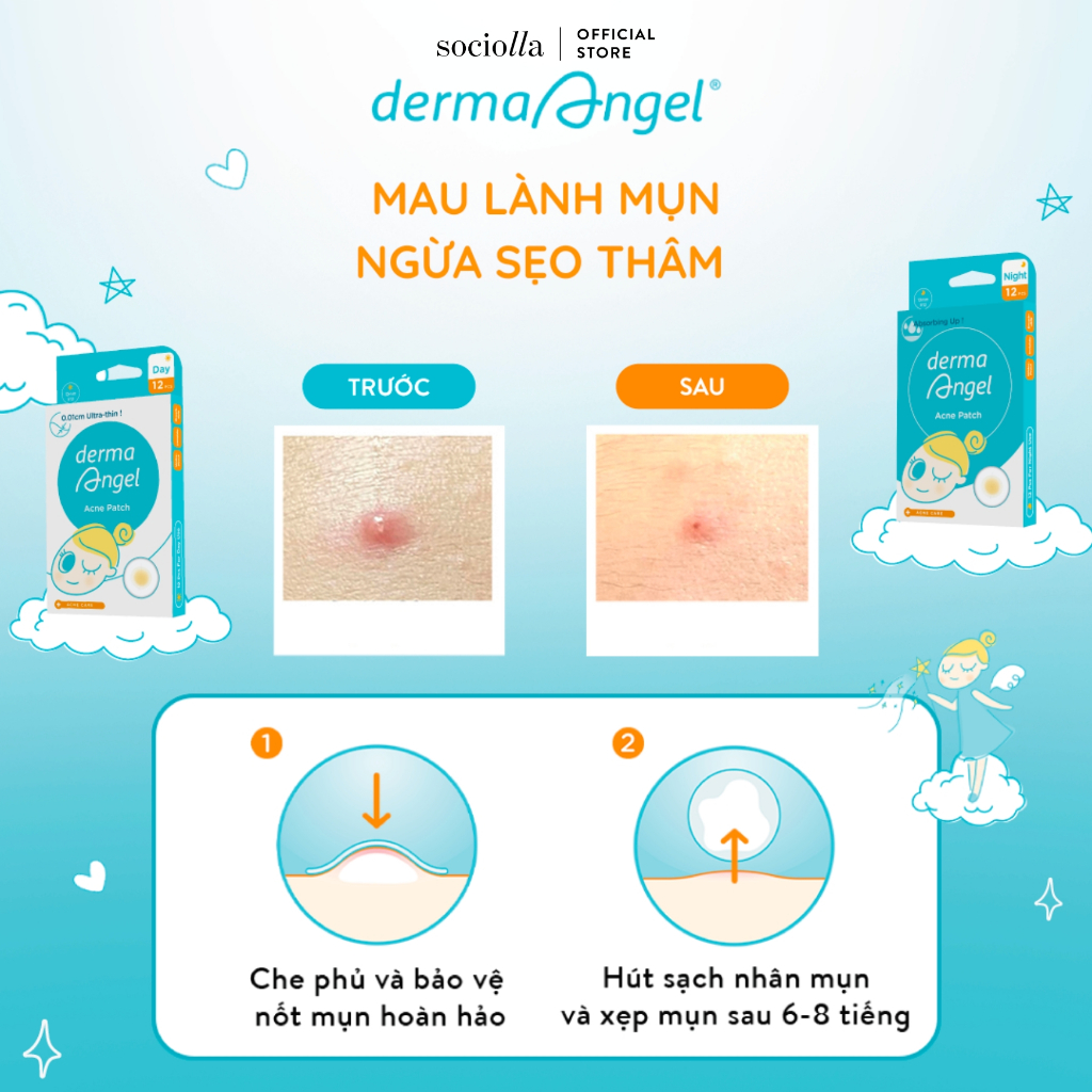 Miếng Dán Mụn Ban Đêm Derma Angel 12 Miếng