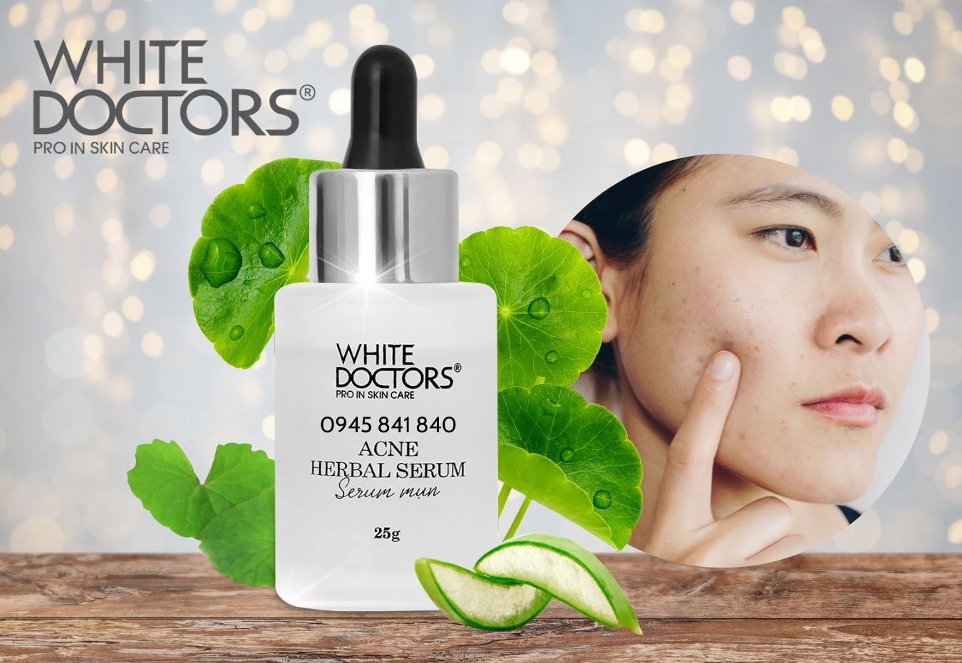 Serum Trị Mụn – White Doctors Acne Herbal Serum