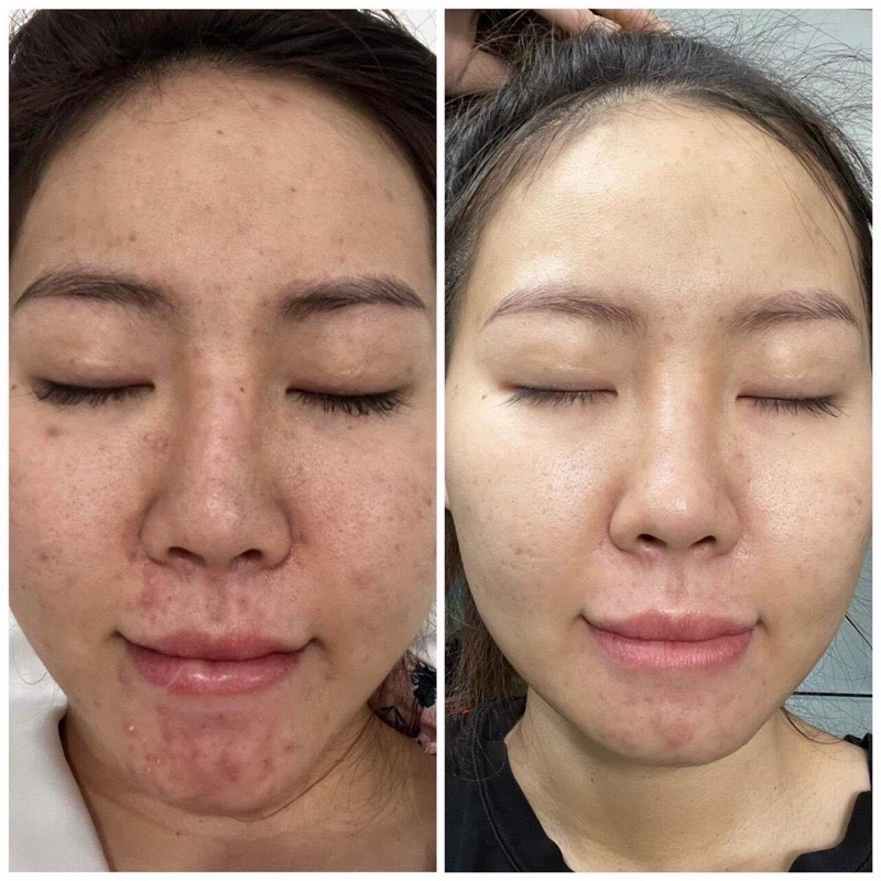 SERUM CỐT HUYẾT THANH THẢO DƯỢC 36 VỊ MEEA [ FREESHIP + QUÀ ]