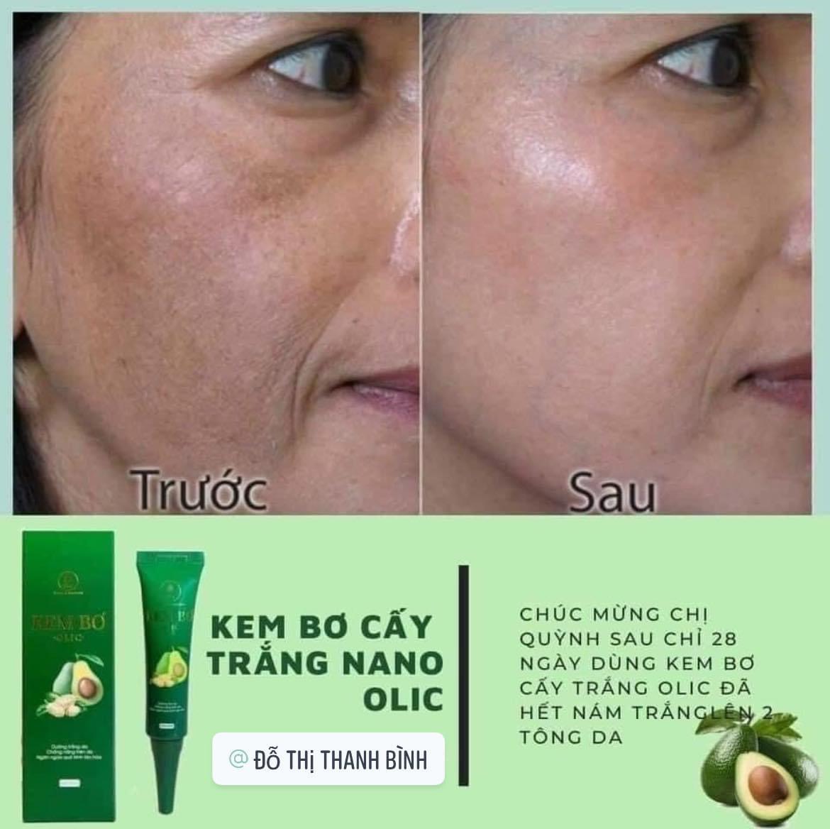 [CHÍNH HÃNG] KEM BƠ CẤY TRẮNG NANO OLIC MẪU MỚI