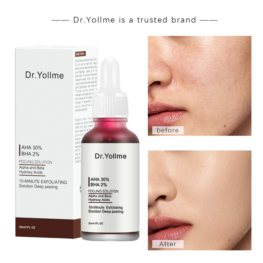 Glycolic Acid Solution Deep Cleansing Pores Softening Keratin BHA Salicylic Acid Serum 30ml