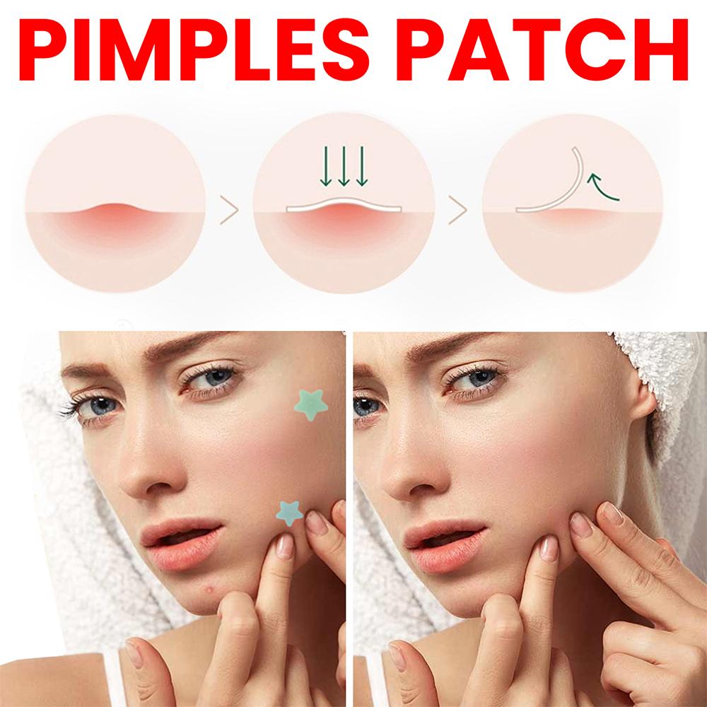 200pcs%20Star%20Pimple%20Patch%20Acne%20Colorful%20Invisible%20Acne%20Removal%20Skin%20Care%20Stickers%20Face%20Spot%20Beauty%20Makeup%20Tool%20Beauty%20Dropshiping%20-%20Image%206