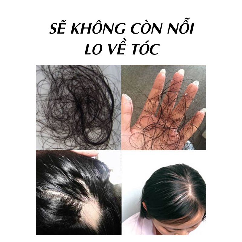 [Hàng sạch chất lượng cao] Bồ kết trái khô 1kg - Tấn Phát - Hàng công ty chất lượng cao