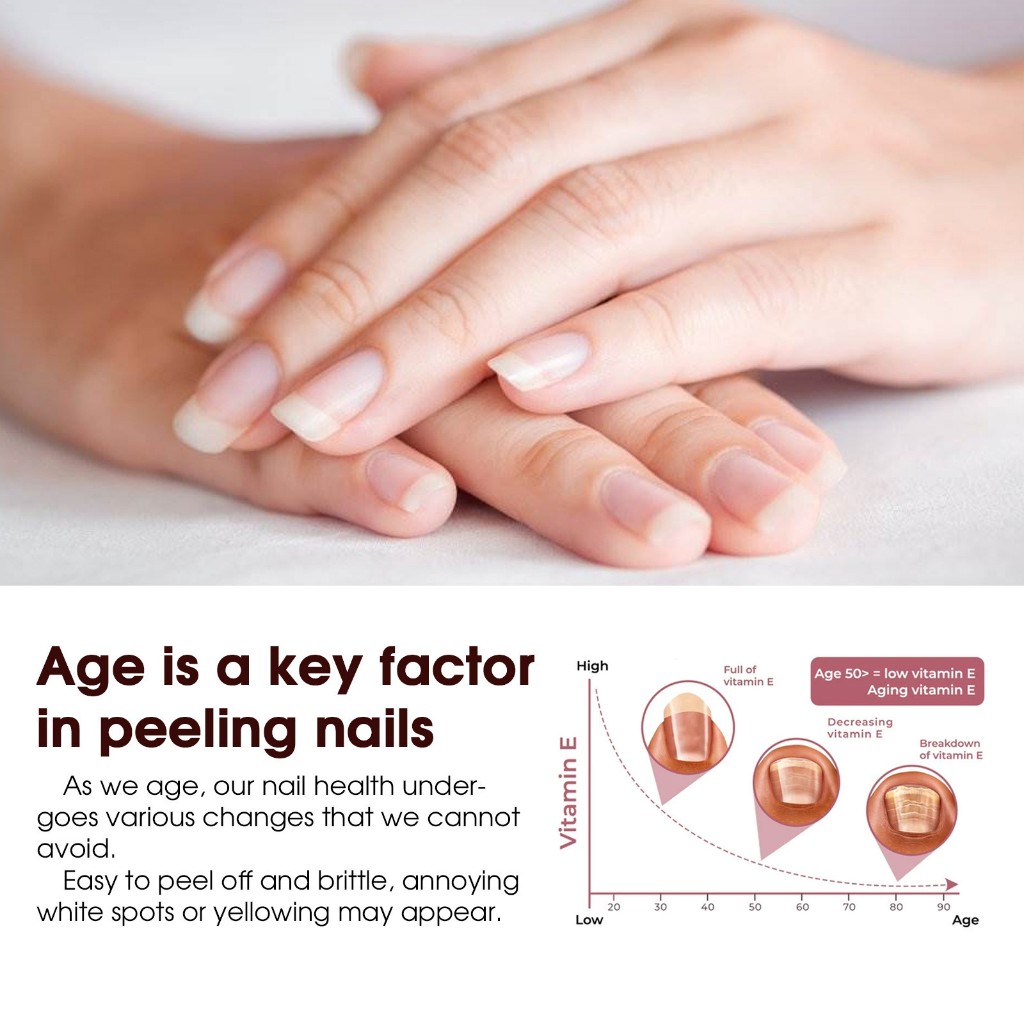 Dưỡng móng Peeling Nail hồi phục móng hư tổn