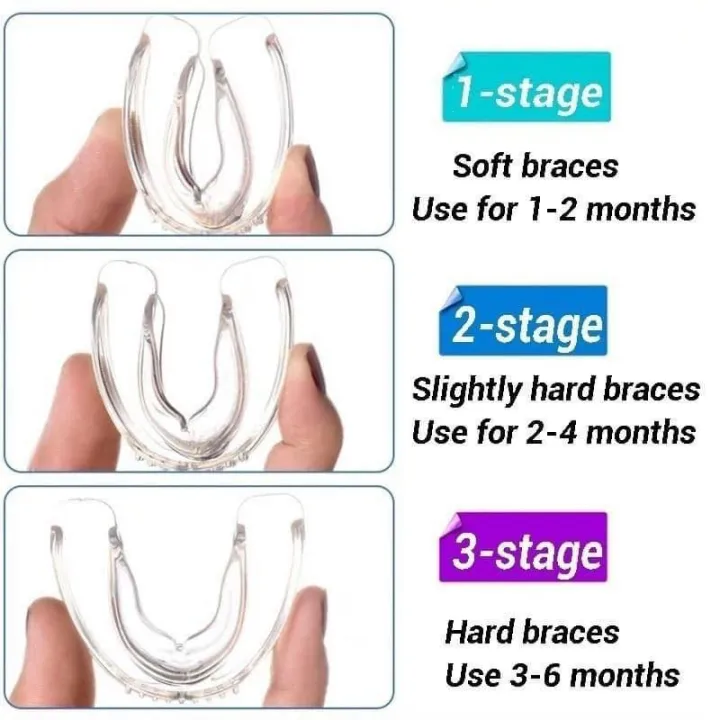 (A3, third stage, hard braces)Teeth retainer dental health care brace Teeth Alignment Trainer Retainer Mouth Guard Dental Care. 