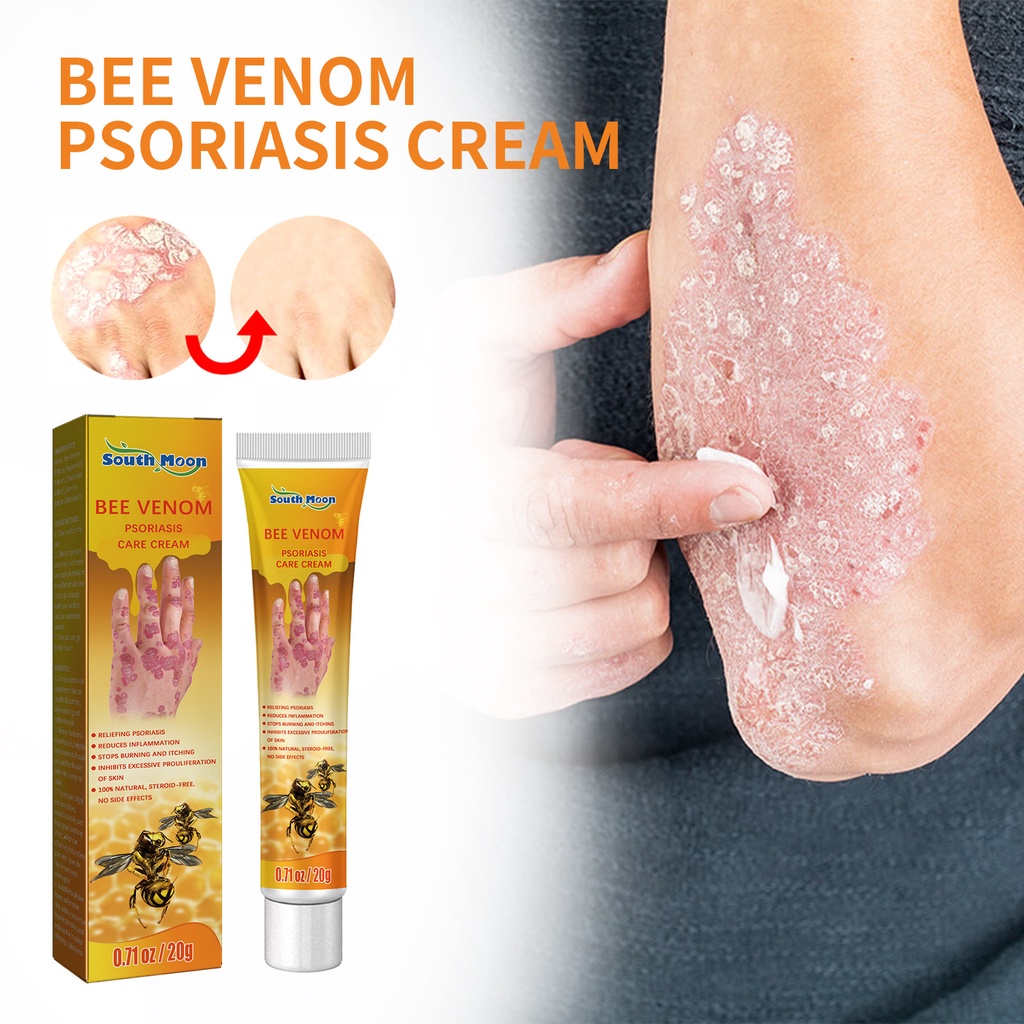 20g Bee Venom Psoriasis Treatment Cream Bee Venom Ointment Bee Venom Psoriasis Treatment Cream Bee Venom Ointment Bee Venom Cream