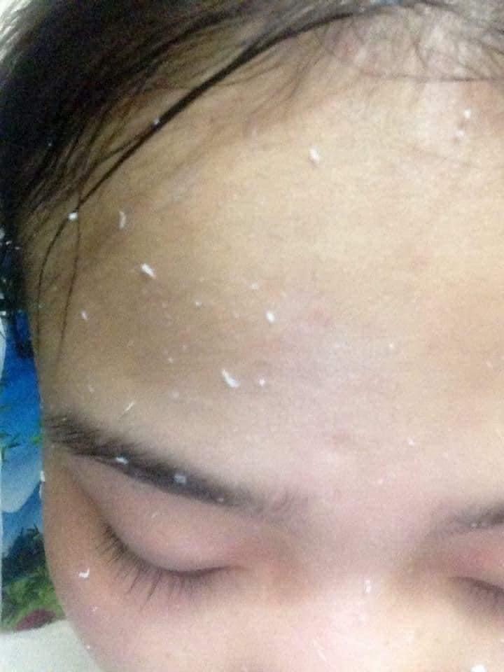Tẩy da chết spa