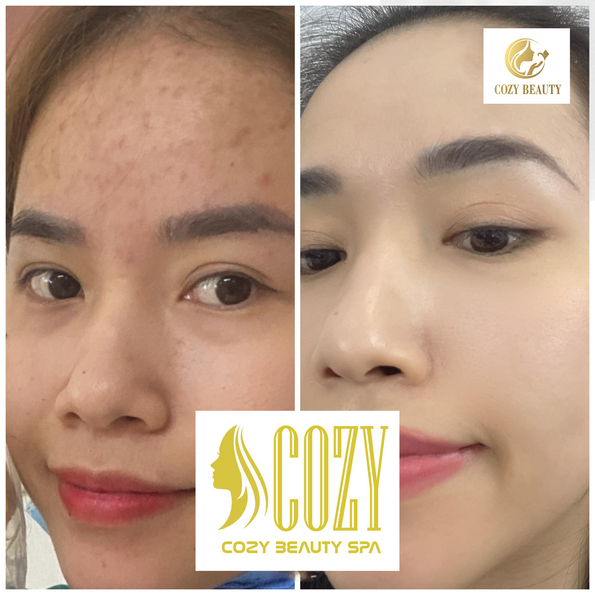 SERUM face