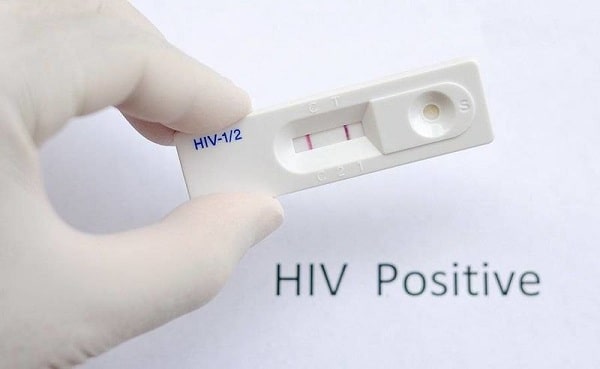 Bộ test HIV SD BIOLINE HIV-1/2 3.0