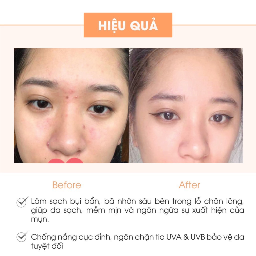 Kem Face Pháp Acosmetics Mẫu Mới [Hàng Chính Hãng]