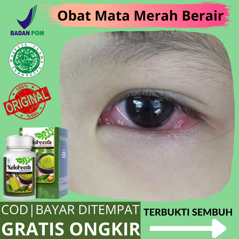 Vitamin Mata Untuk Dewasa Dan Anak Herbal Eyes Untuk Mata Plus Dan vitamin-mata-untuk-dewasa-dan-anak-herbal-eyes-untuk-mata-plus-dan