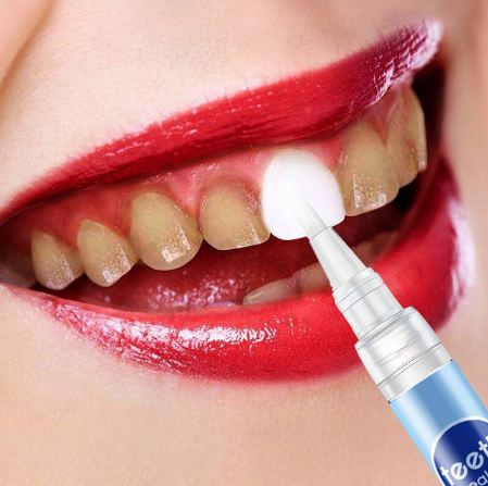 Bút tẩy trắng răng Dazzling White chính hãng
