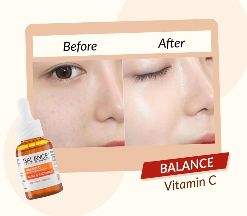 Serum Sáng Da Mờ Thâm Balance Vitamin C 30ml