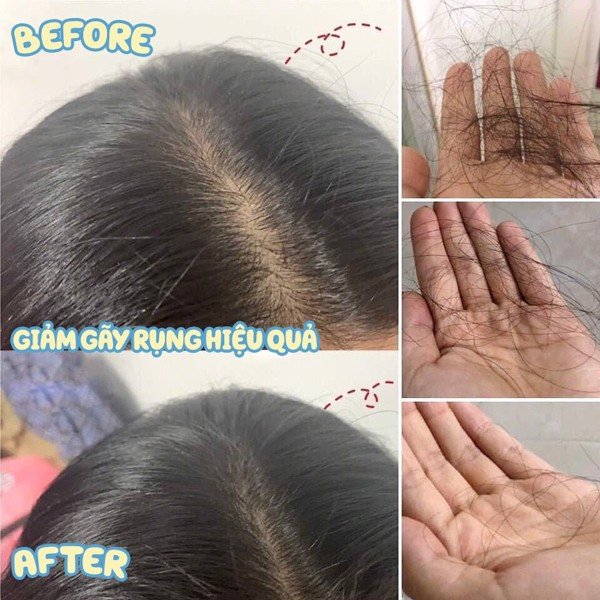 Tinh Chất Kích Thích Mọc Tóc Thảo Dược SATO Nhật Bản - 30ml