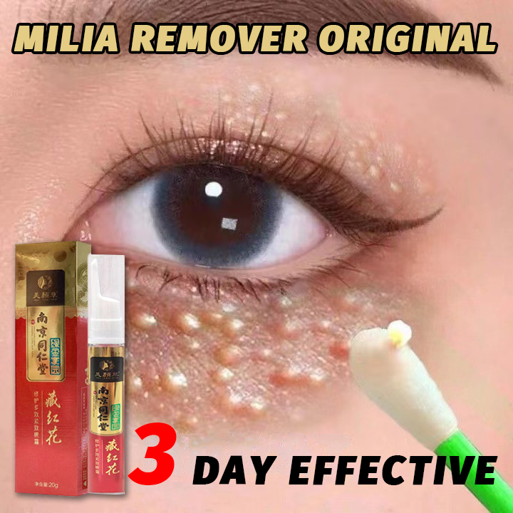 Milia Remover Cream Original 20ml Eye Bag Remover Original Butlig Sa