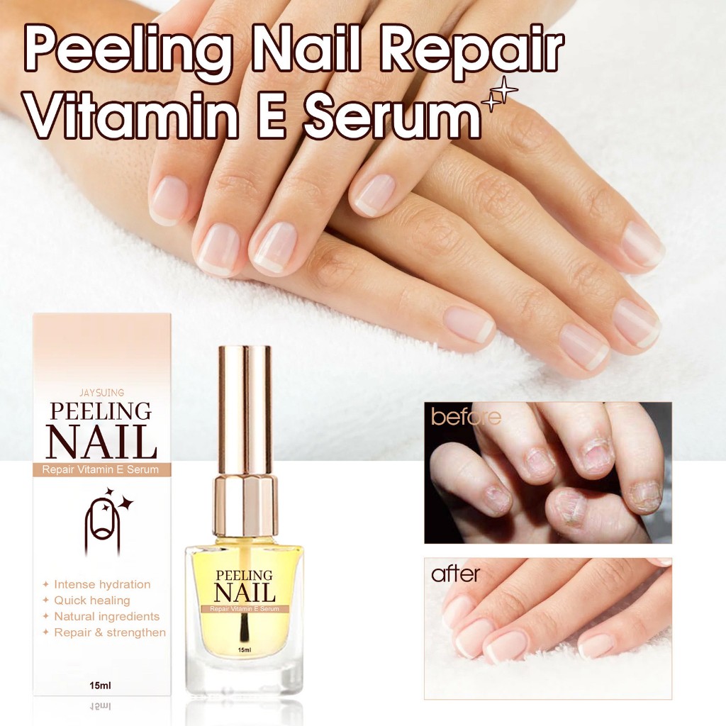 Dưỡng móng Peeling Nail hồi phục móng hư tổn