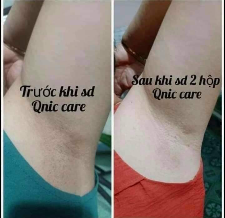 Kem thâm nách và bikini QNIC Thái Lan