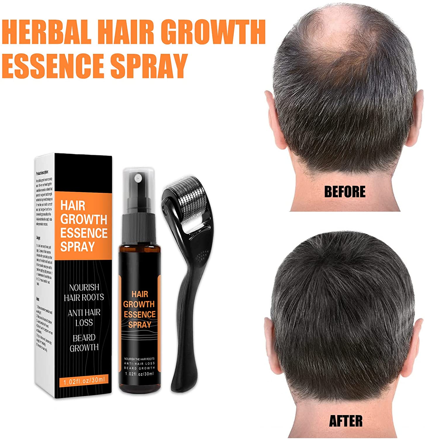 2022 Bio'Tech Advanced Regrowth Treatment Kit, Hair Regrowth Roller+