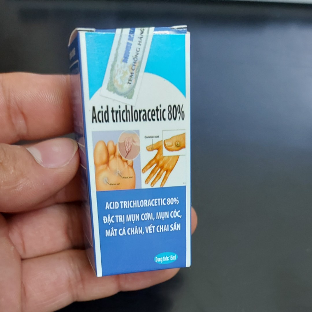 Hết mụn cóc, mụn cơm, vết chai sần mắt cá chân lọ 15ml