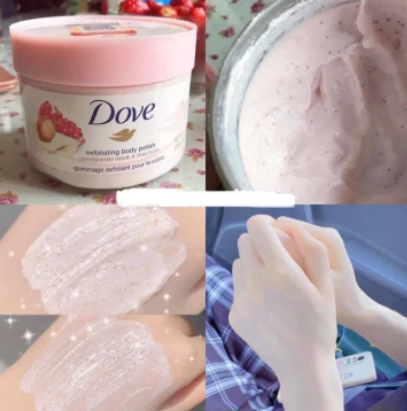 Dove German Exfoliator - 298g