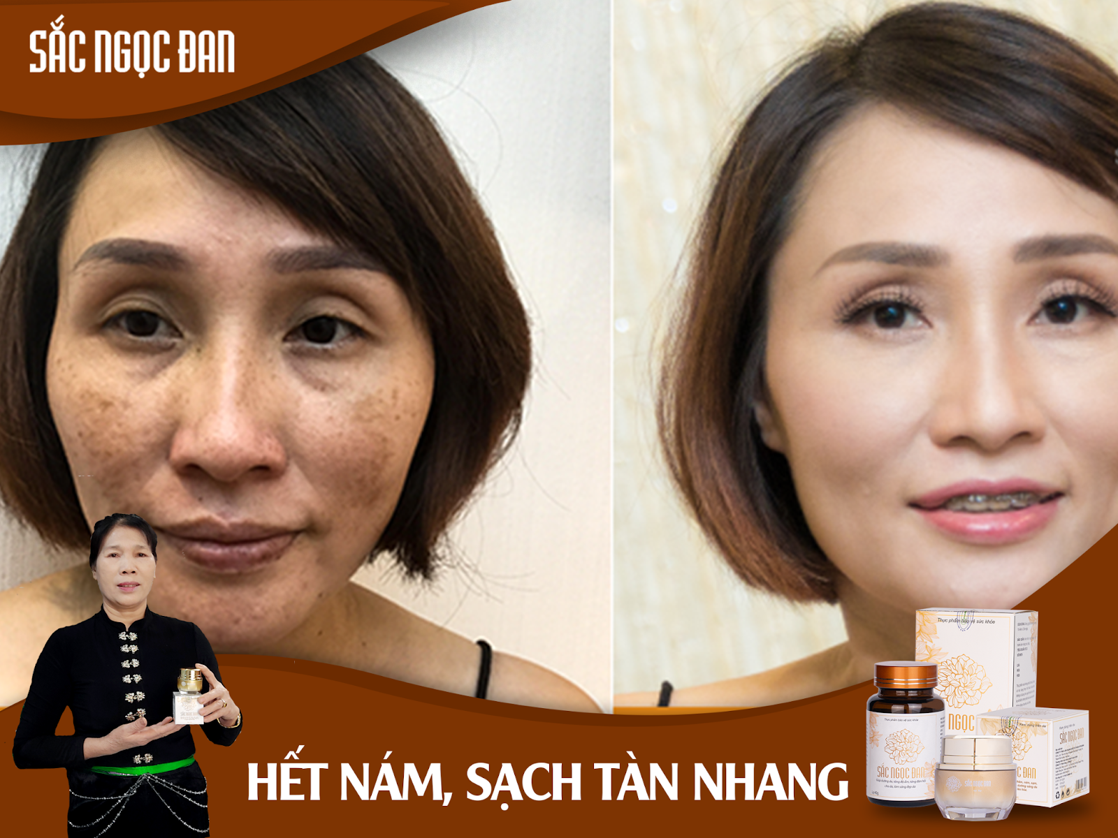 Sắc Ngọc Đan - Xóa mờ thâm nám, tàn nhang