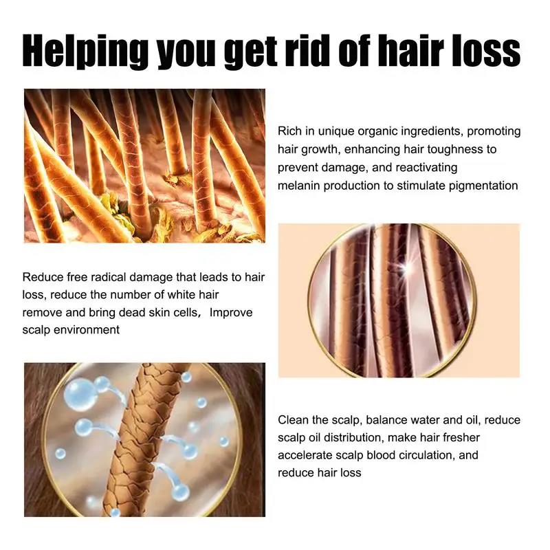 7-day Rapid Hair Growth Essential Oil Hair Regeneration Oil Anti-hair Loss Mild Repairs Hereditary Hair Essential Oil New. 