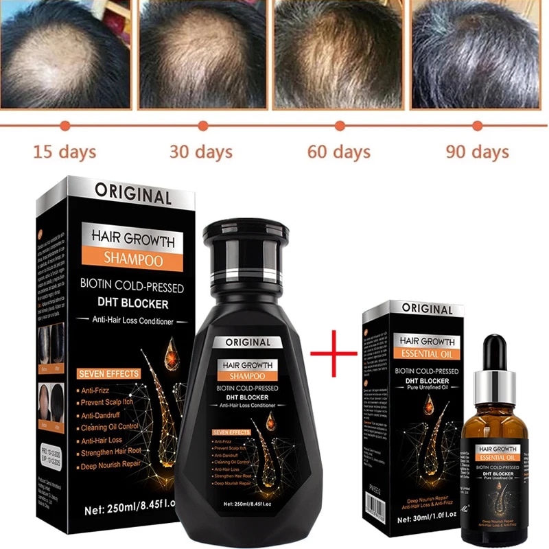 【Worth-Buy】 Hair Growth Essential Biotin Cold-Pressed Dht Blocker And Hair Growth Shampoo Anti-Hair 