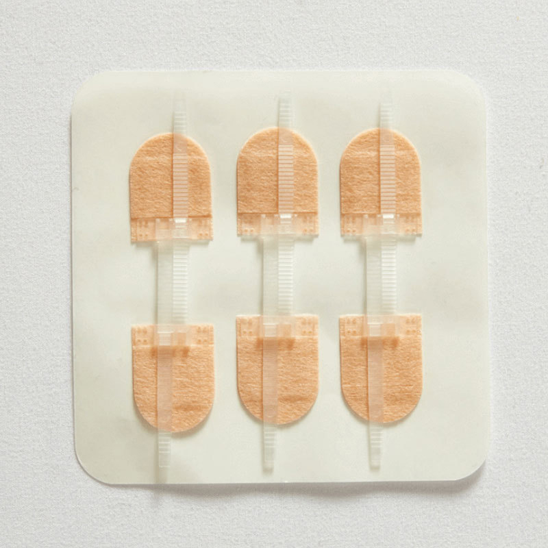 3Pcs/set%20Zipper%20Tie%20Wound%20Closure%20Patch%20Hemostatic%20Patch%20Wound%20Fast%20Suture%20Zipper%20Band-Aid%20Outdoor%20Portable%20Natuo%20-%20Image%202