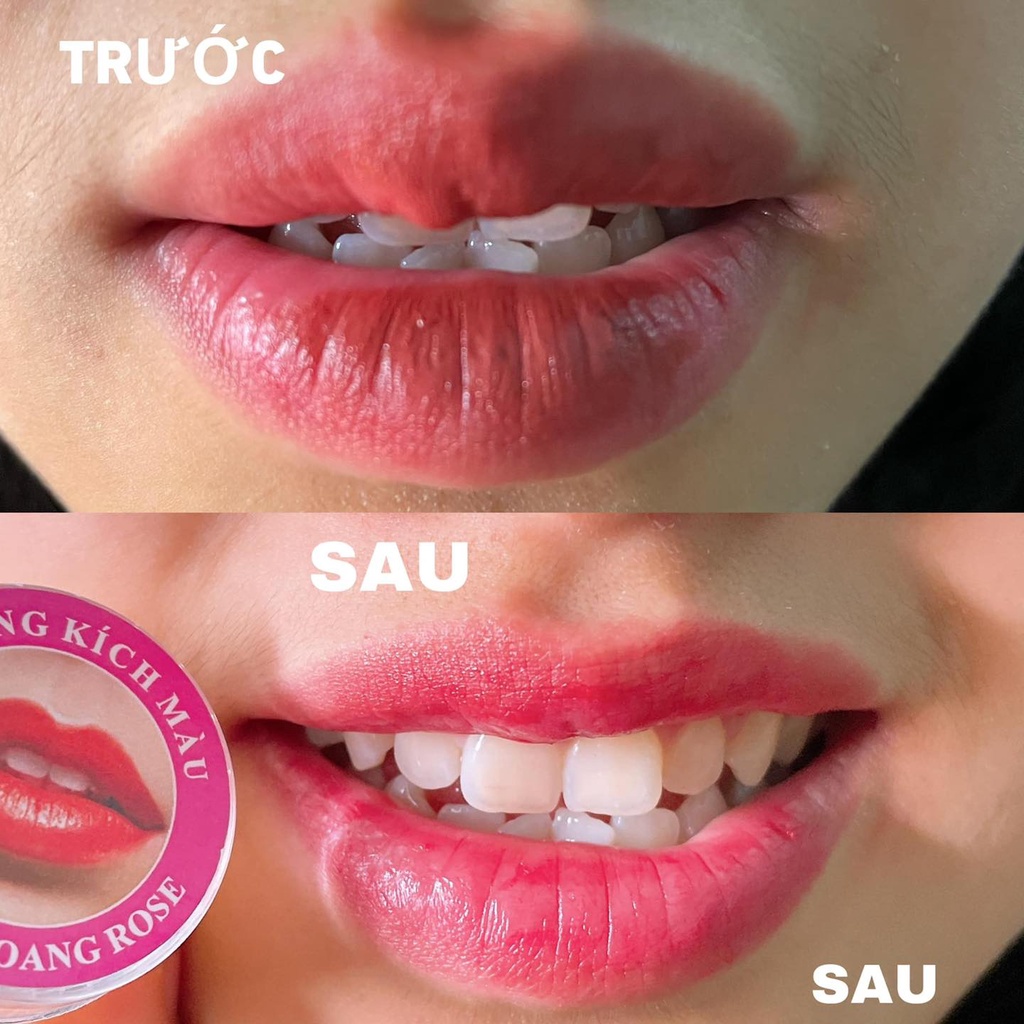DƯỠNG KÍCH MÀU THÂM LOANG ROSE