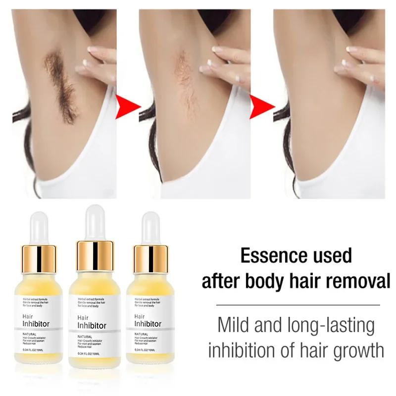 HeYang Permanent Hair inhibition Serum Painless Hair Remover Armpit Legs Arms Hair Growth Inhibitor Beauty Skin Care Body Essential Oil phone case.