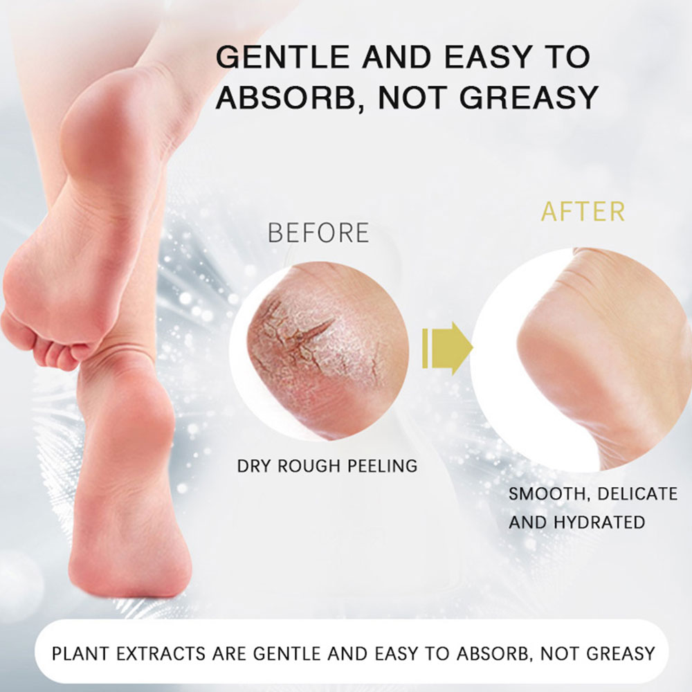 phone case Horse Oil Foot Cream Hand Foot Care Cream Moisturizing Anti Aging Body Skin Moisturizing Removal Hand Care Mask Feet Pedicur. 