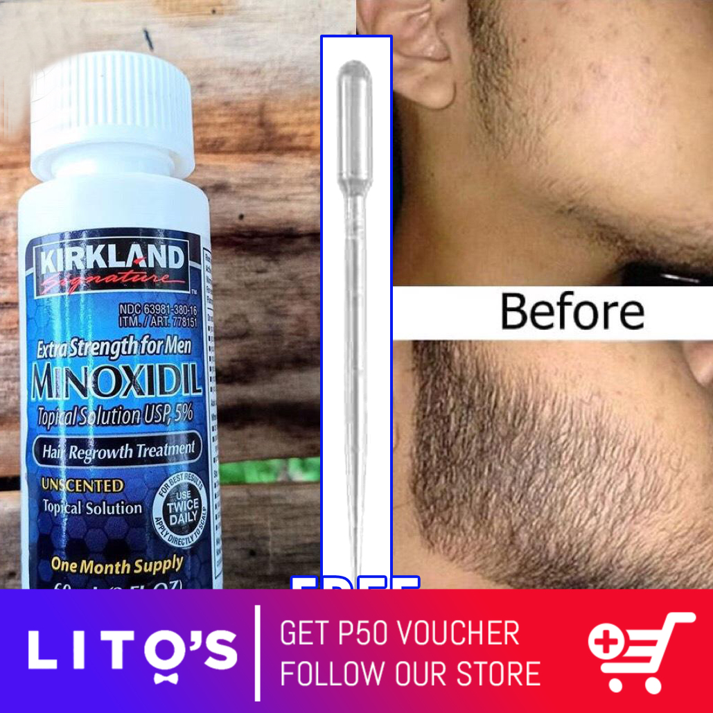 TOPICAL) Minoxidil 5% Extra Strength Hair Regrowth for Men 60ml (minoxidil kirkland, fast delivery) | Lazada PH