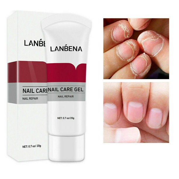 High quality LANBENA Nail Repair Essence Serum Fungal Nail Treatment Remove  Onychomycosis /KL Selangor Market | Lazada