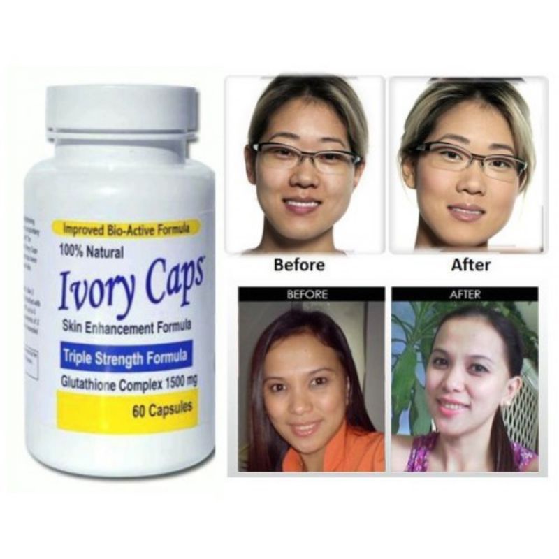 miracle white advanced whitening glutathione MIRACLE WHITE GLUTATHIONE FOOD SUPPLEMENTS 500mg with SAKURA FLOWER from  JAPAN 30s/bottle Advanced Whitening System Collagen Capsules Beauty From  Within - Lazada