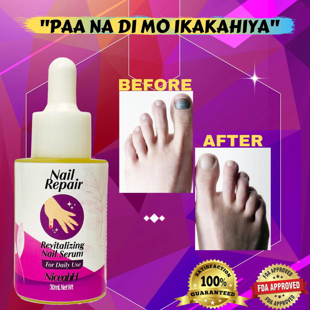 Original Nail Repairnail fungus treatmentnail repair treatment cream