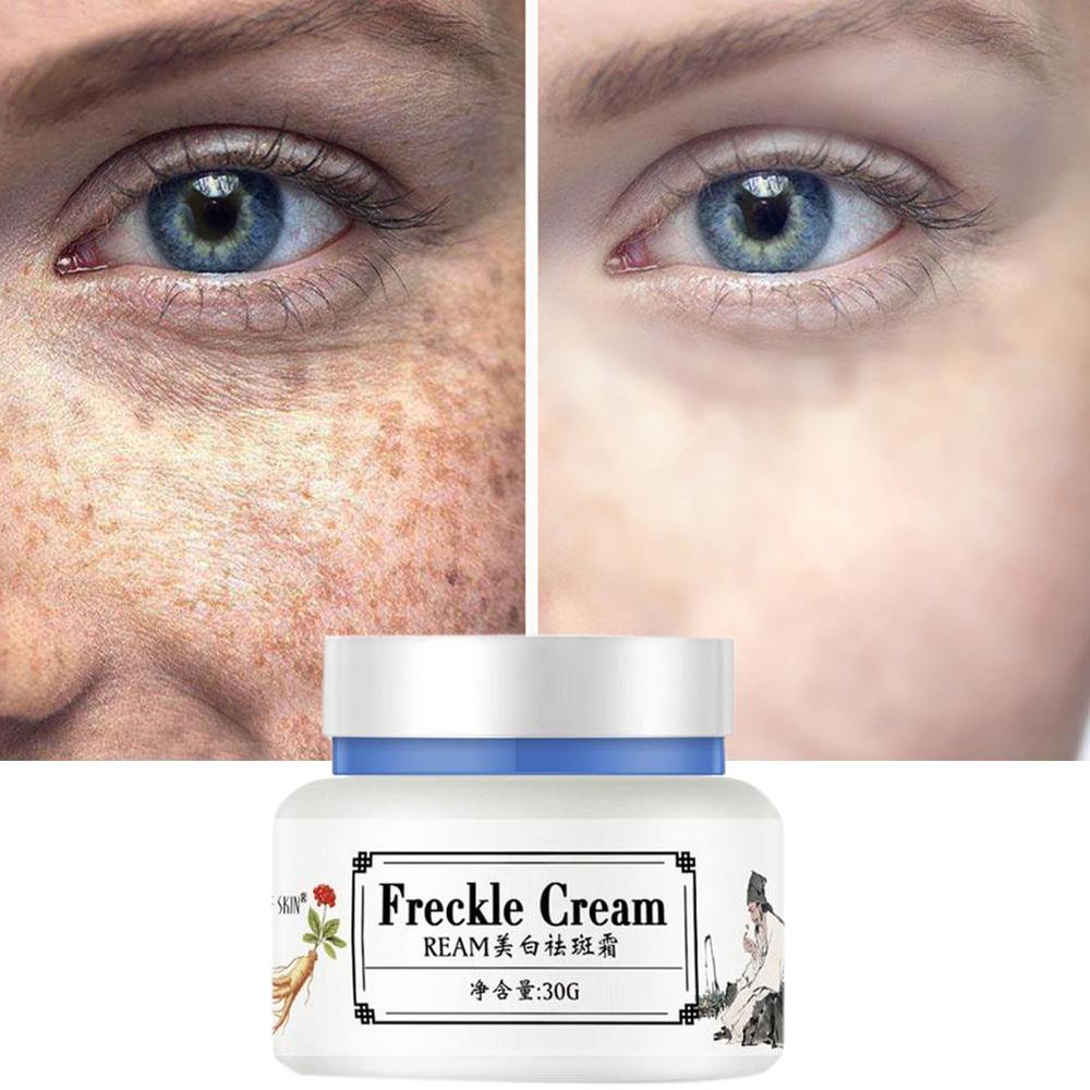 Effective Eyebag Remover Cream Eye Dark Spot Removal Effective Safe for