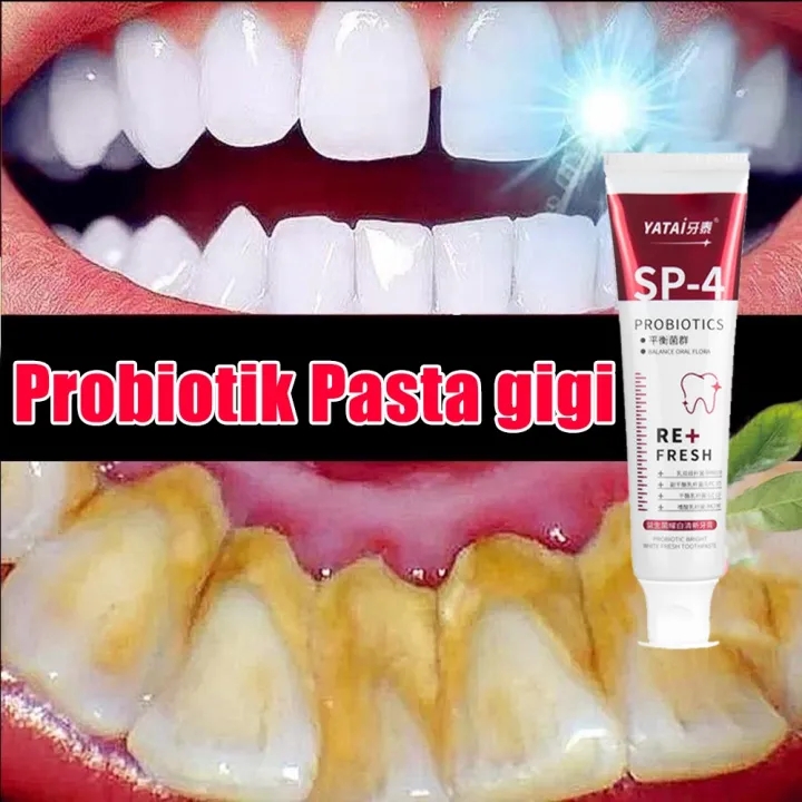 Pasta Gigi Pemutih Toothpaste Pemutih Gigi Kebersihan Mulut, Pasta Gigi