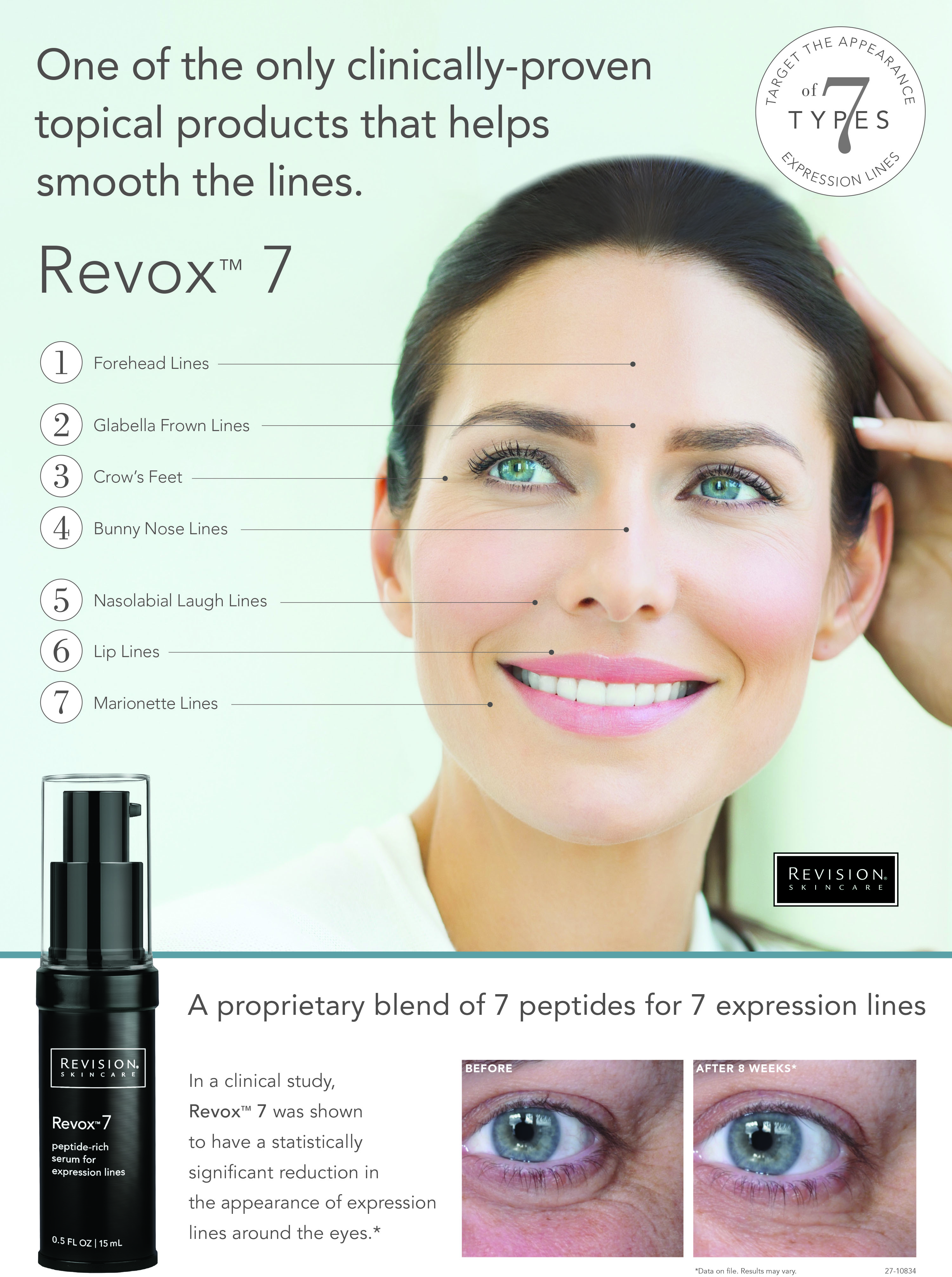 revision revox 7