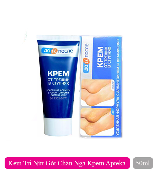 Kem dưỡng ẩm, giảm khô nứt nẻ gót chân Kpem Apteka của Nga (hộp 50ml)