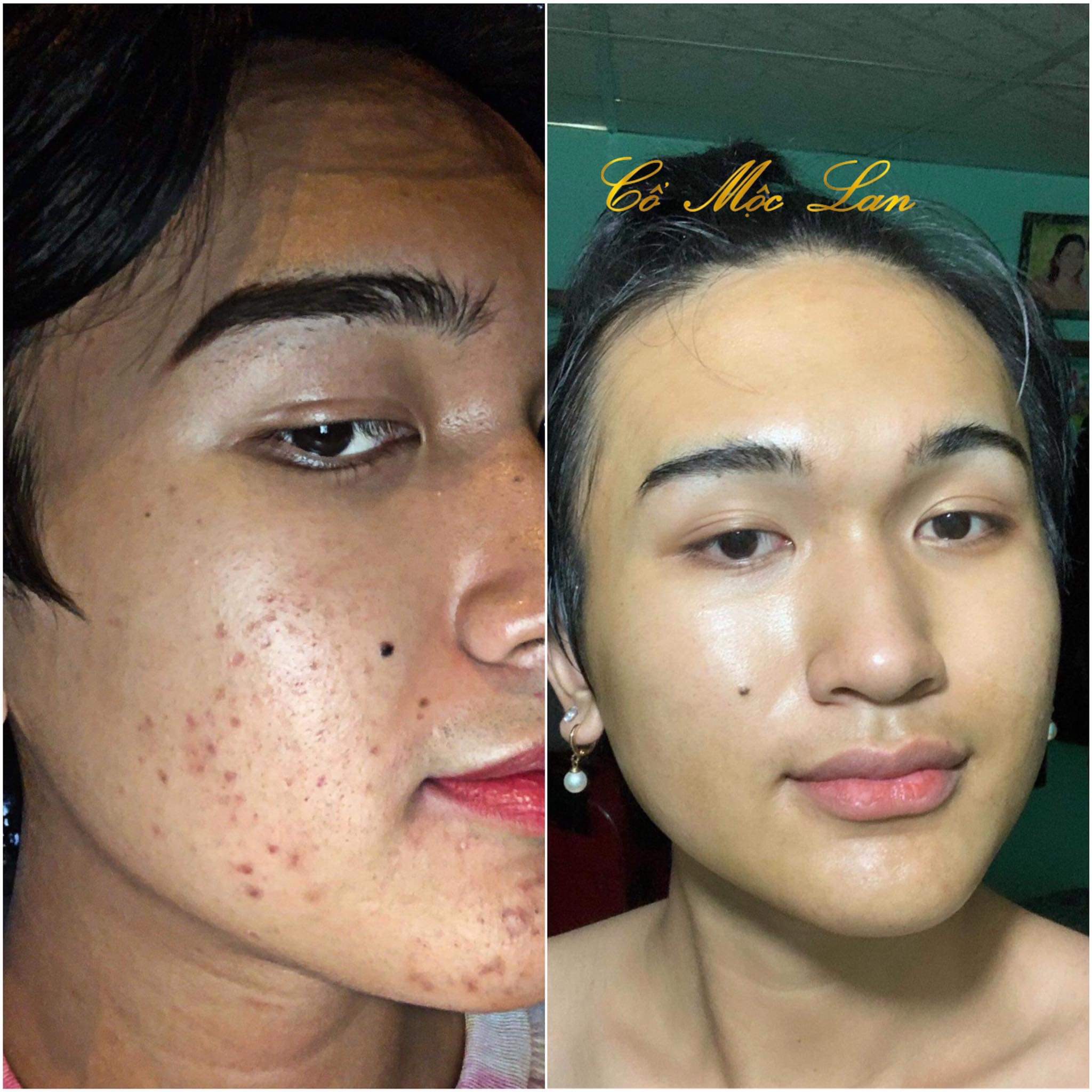 Renew skin Cổ Mộc Lan 20ml