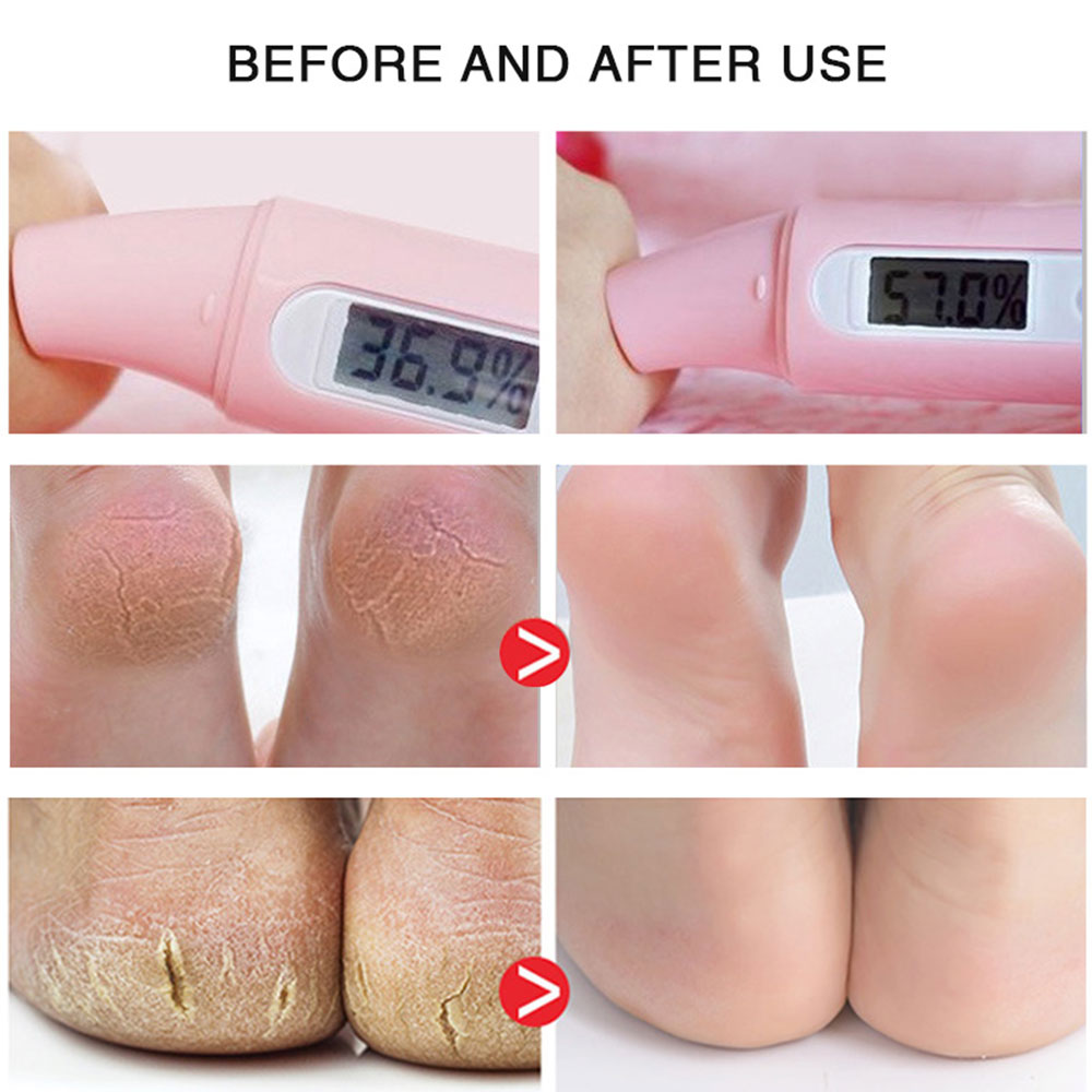 phone case Horse Oil Foot Cream Hand Foot Care Cream Moisturizing Anti Aging Body Skin Moisturizing Removal Hand Care Mask Feet Pedicur. 
