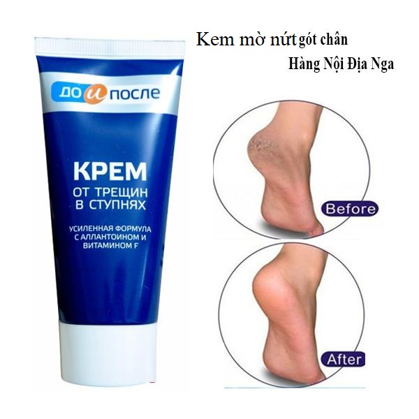[FreeshipMAX] Kem mờ nứt gót chân Kpem dưỡng da chân