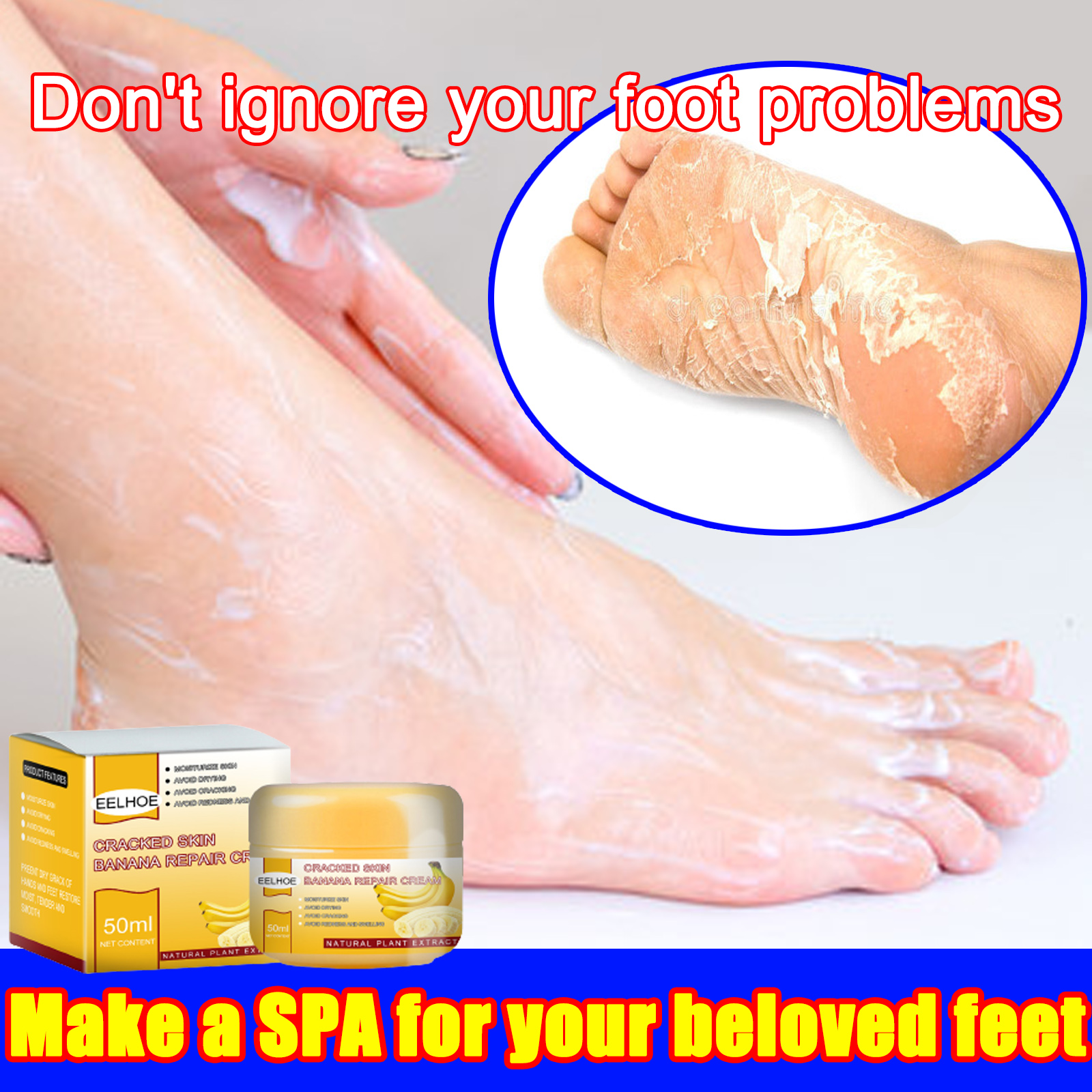 foot-cream-hand-cream-150ml-nourishes-dry-feet-deeply-hydrates-hands