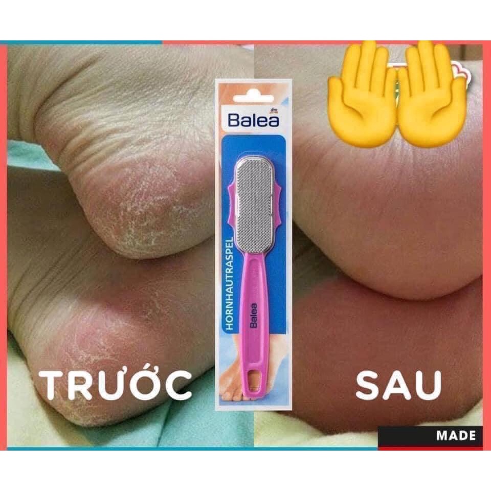 Dụng Cụ Chà Gót Chân Balea, Cây Chà Gót, Bào Gót, Hàng Đức