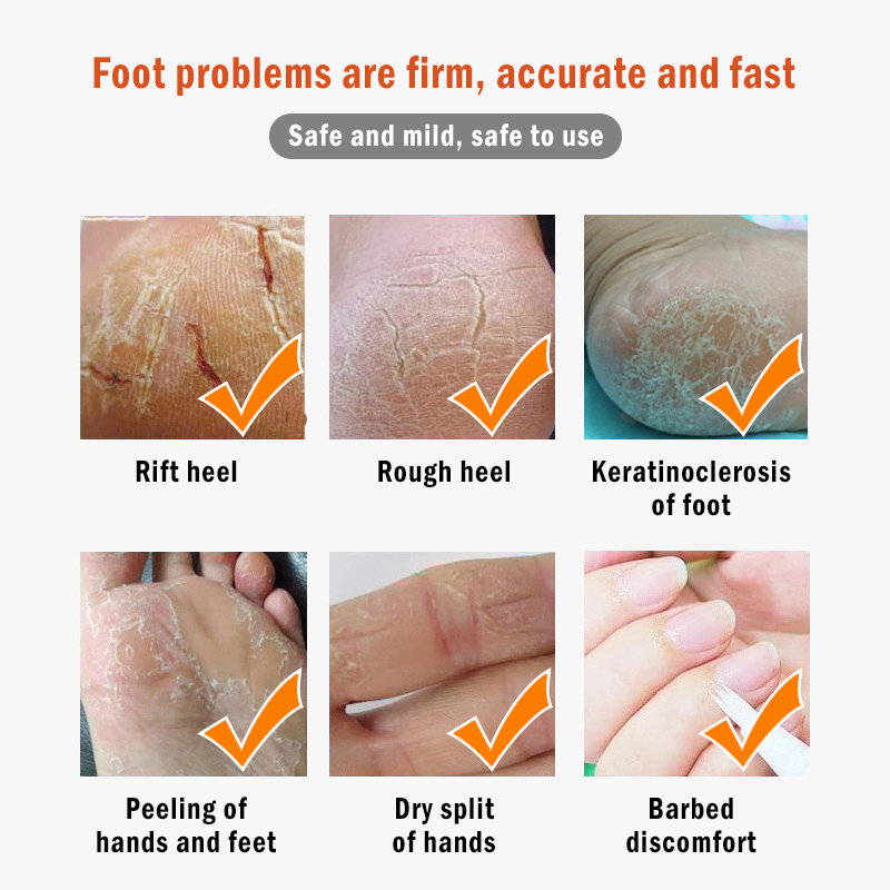 20g Vaseline Moisturizing Hand Foot Dead Skin Remover Banana Oil Anti-dry Crack Foot Cream Cracked Heel Repair Feet Care Cream. 