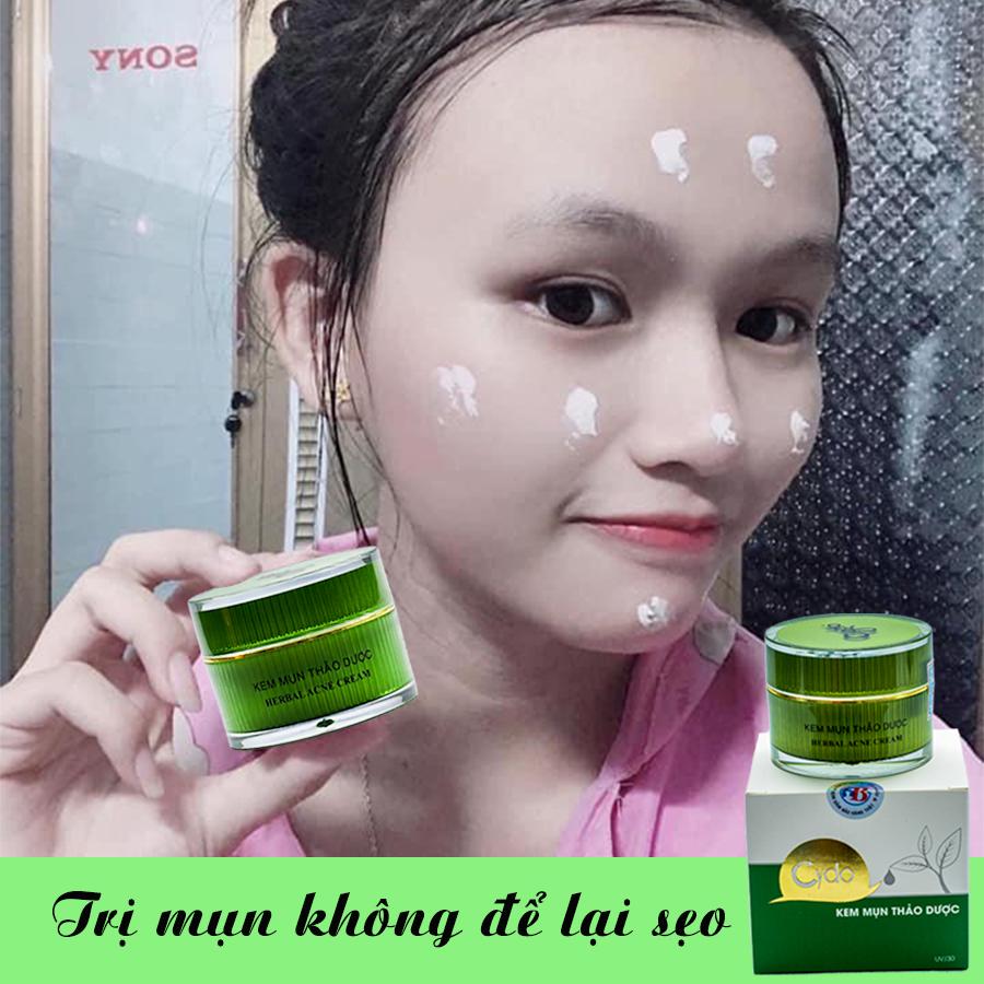KEM MỤN THẢO DƯỢC CYDO