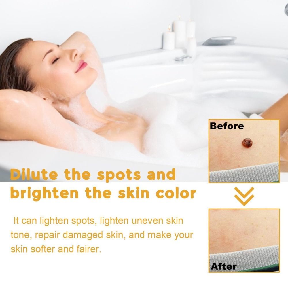 20ML%20Mole%20Skin%20Tag%20Recede%20Bee%20Venom%20Spray%20Painless%20Remover%20Dark%20Spot%20Warts%20Remover%20Effective%20Freckle%20Tag%20Recede%20Bee%20Venom%20for%20Face%20-%20Image%205