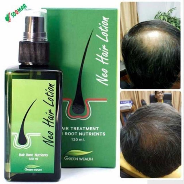 Seller️thái lan neo hair lotion dung dịch dưỡng tóc gốc 120ml