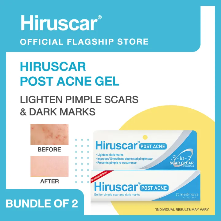 Hiruscar Post Acne Gel 10g Bundle Of 2 Hiruscar Official Store Lazada Singapore